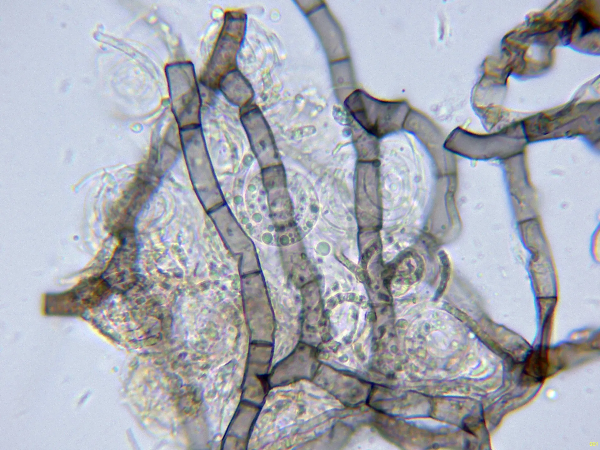 Microscopía de Neohelicosporium griseum - 10 - Hifas conidiógenas agua-001